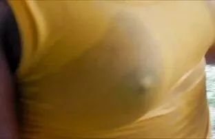 XXX پزشک شگفت انگیز بیمار را سحاق مخفي با رابطه جنسی مقعد درمان کرد